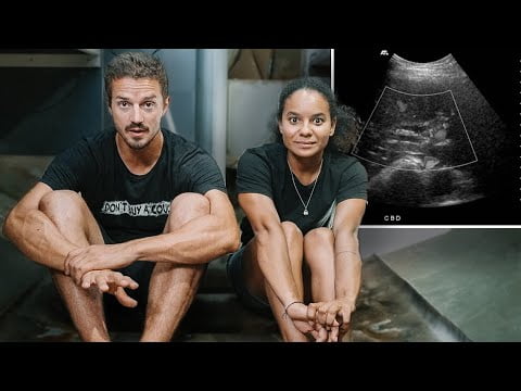 This ULTRASOUND Will Determine Our Future | Step 359