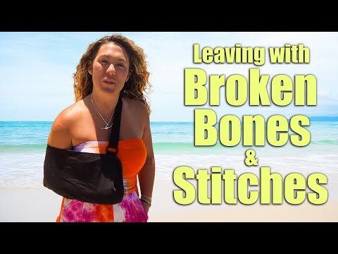 Chelsea has to leave the boat broken bones and stiches!